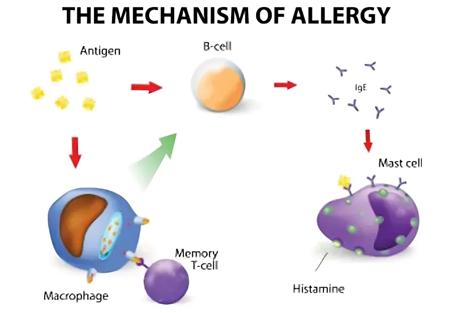 Treatment of Food Allergies in Children