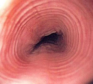 esophagus