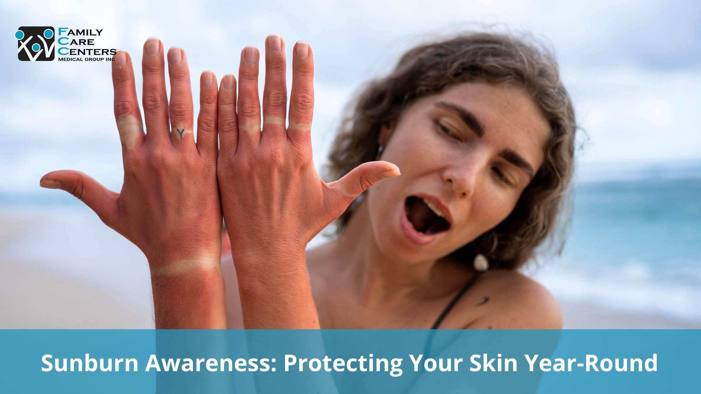 Sunburn Awareness: Protecting Your Skin Year-Round