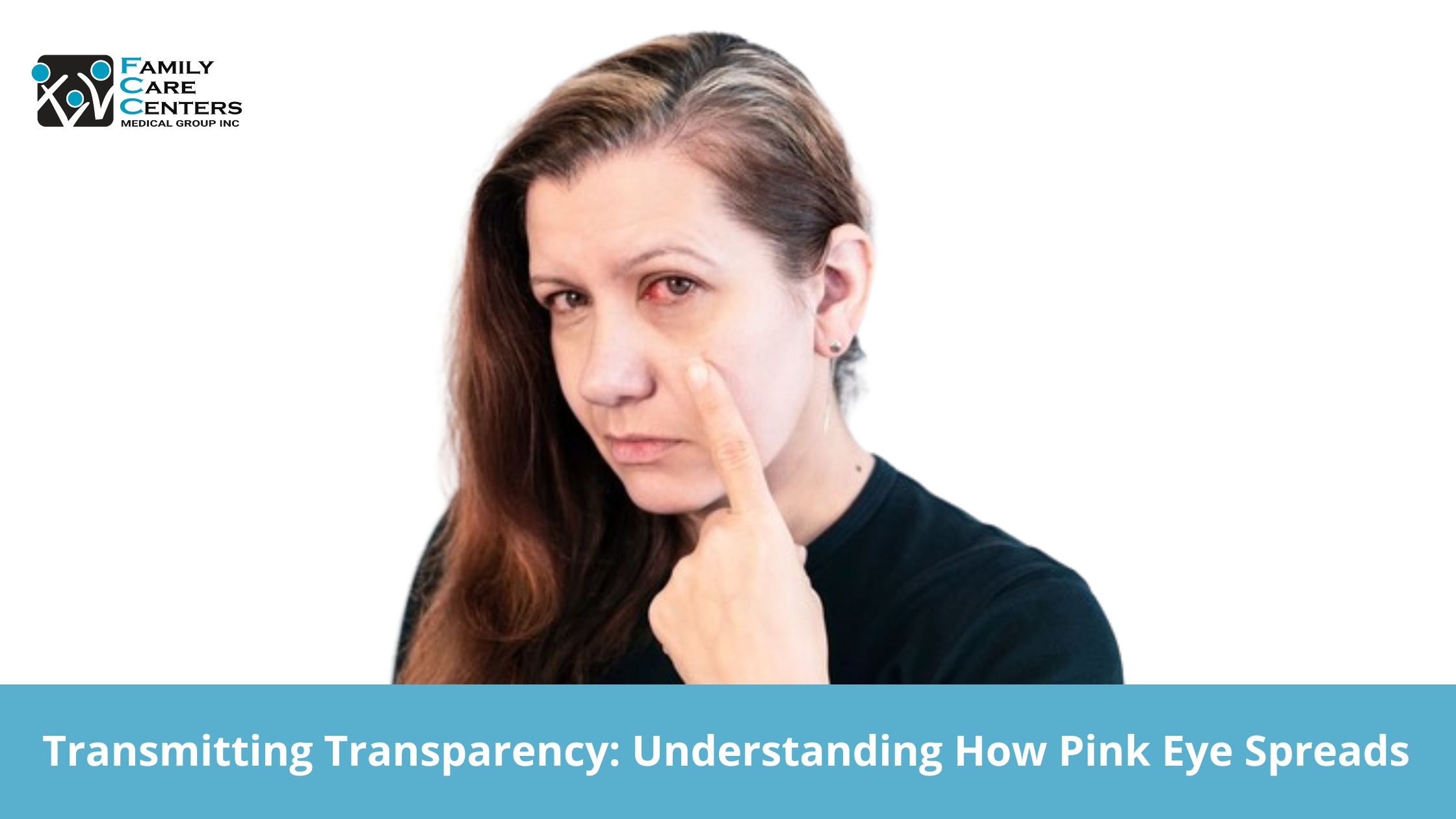 Transmitting Transparency: Understanding How Pink Eye Spreads