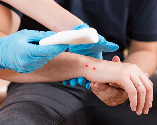 When Are Antibiotics Prescribed for Skin Lacerations?