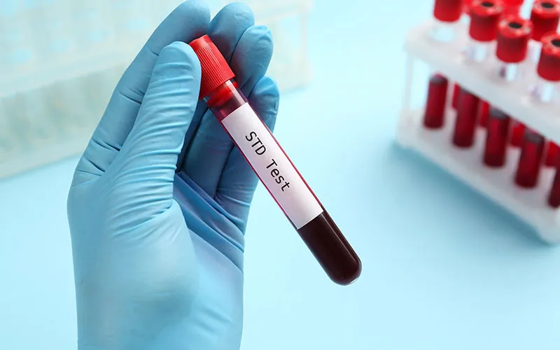 Understanding STD Testing 