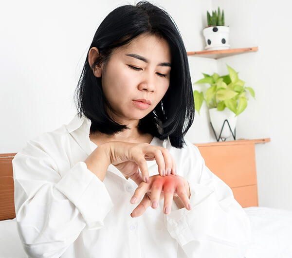 Symptoms of Insect Bites