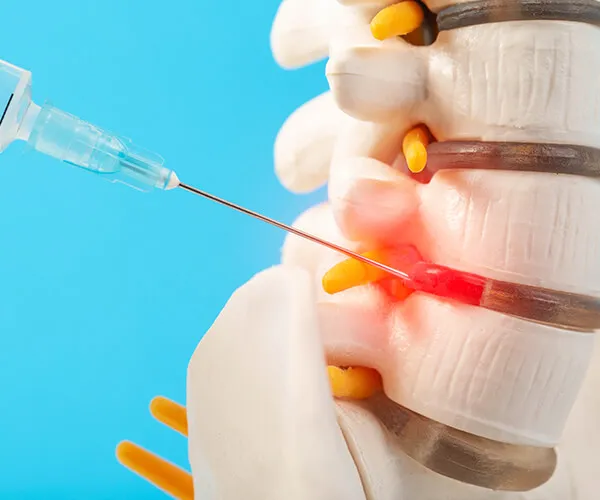 Are Facet Joint Injections Worth It?