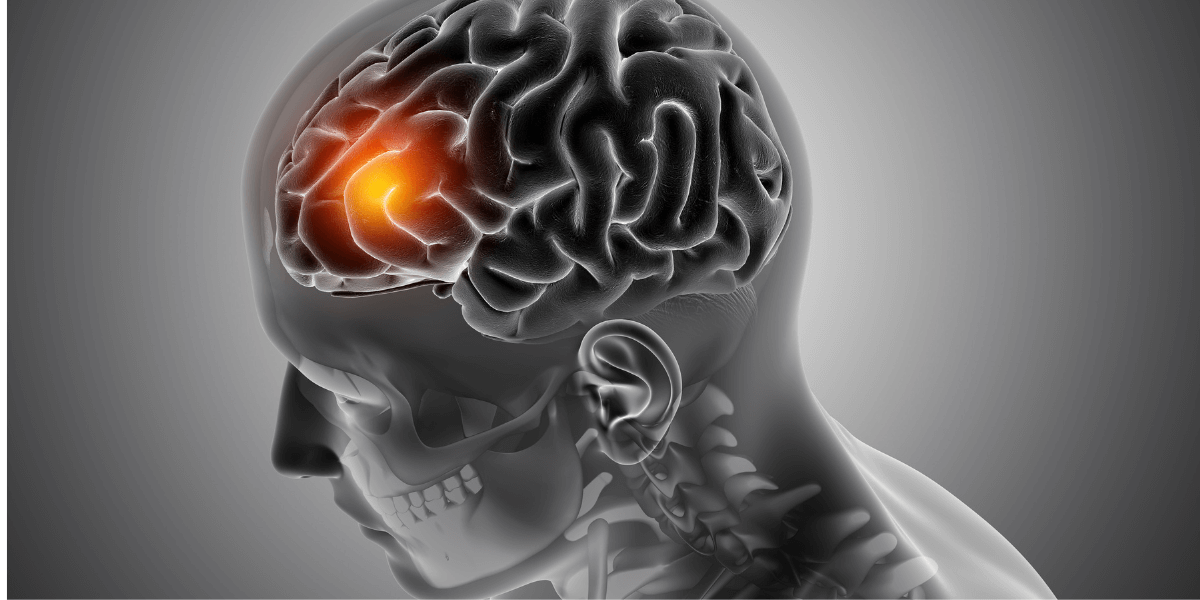 Understanding Peripheral Nerve Blocks for Acute and Chronic Pain Relief
