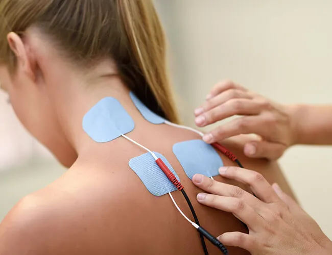 Peripheral Nerve Stimulator