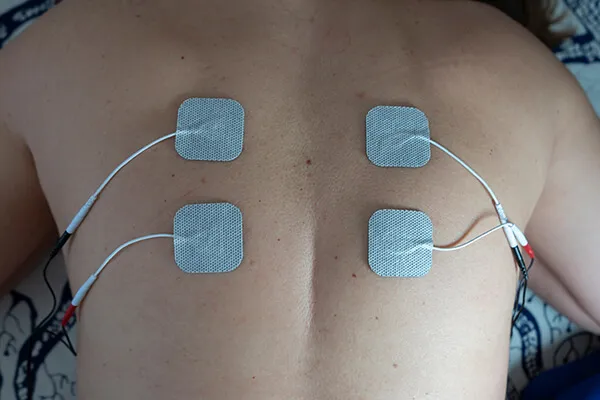 How Does a Spinal Cord Stimulator Work?