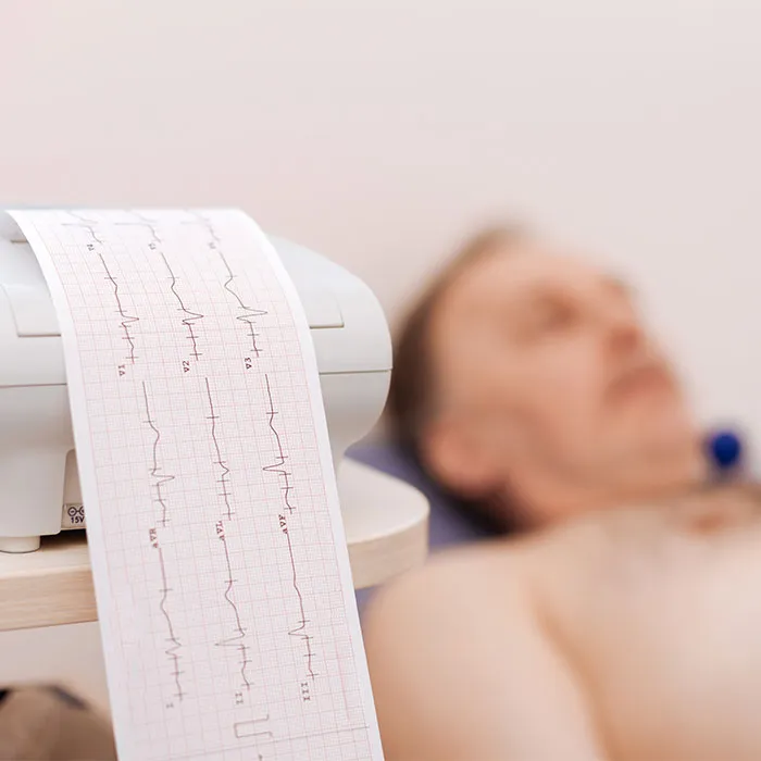 What Is an EKG Test