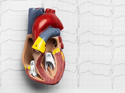 Coronary Artery Disease (CAD) Thumb
