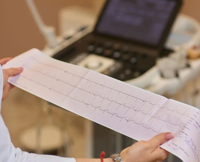 In-Office EKG at SD Premier Clinics