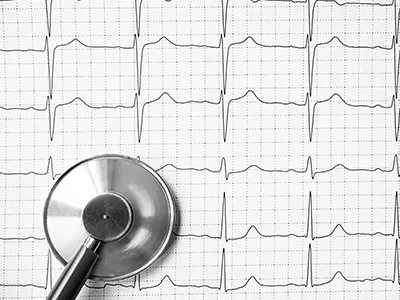 Heart Arrhythmia Thumb
