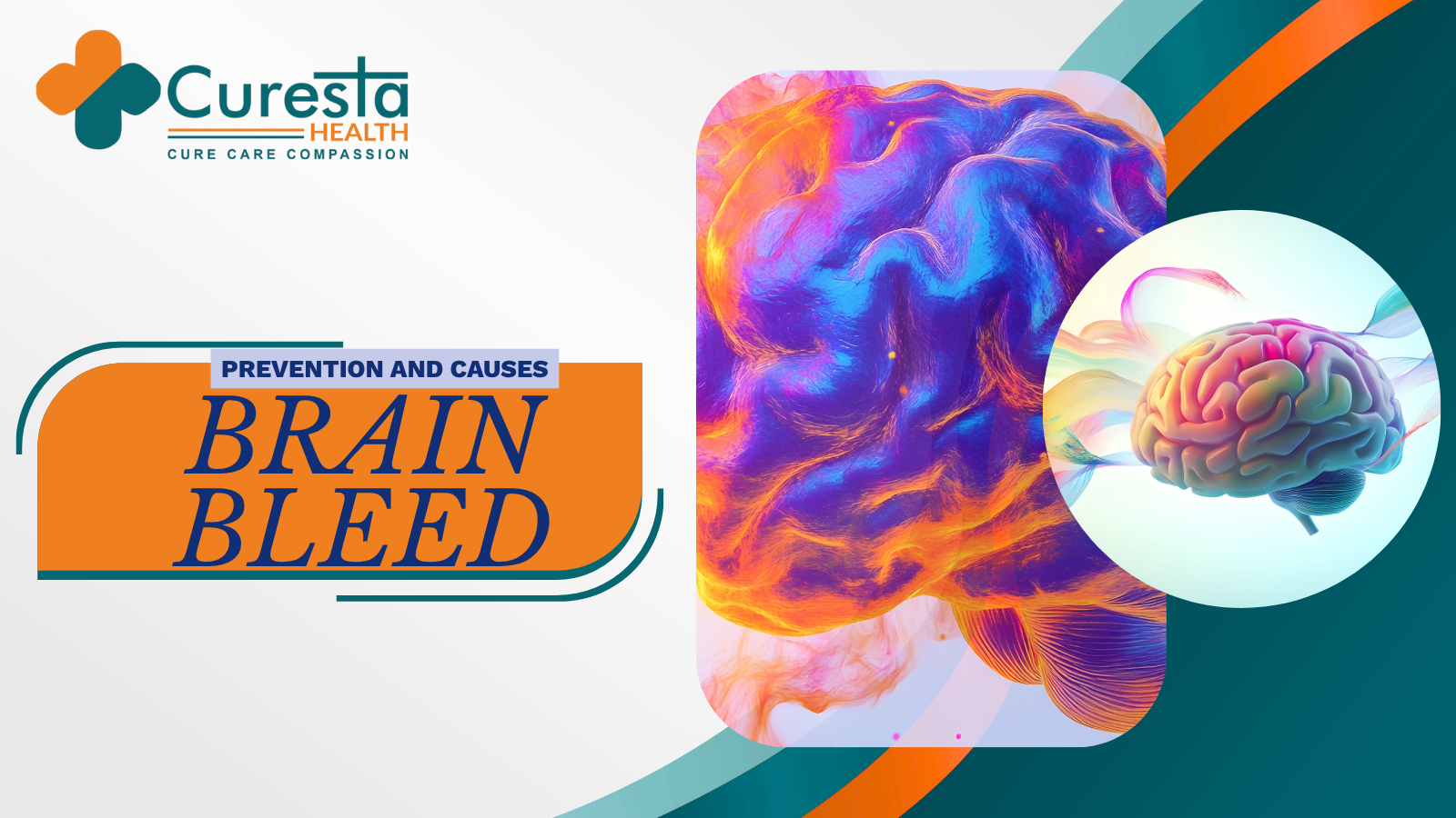 Prevention and causes of Brain Bleed