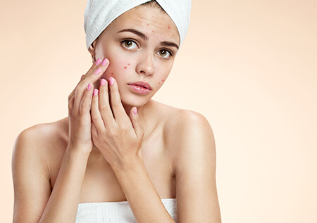 Experience the Best Acne Treatment Services Near You at Haven Medspa
