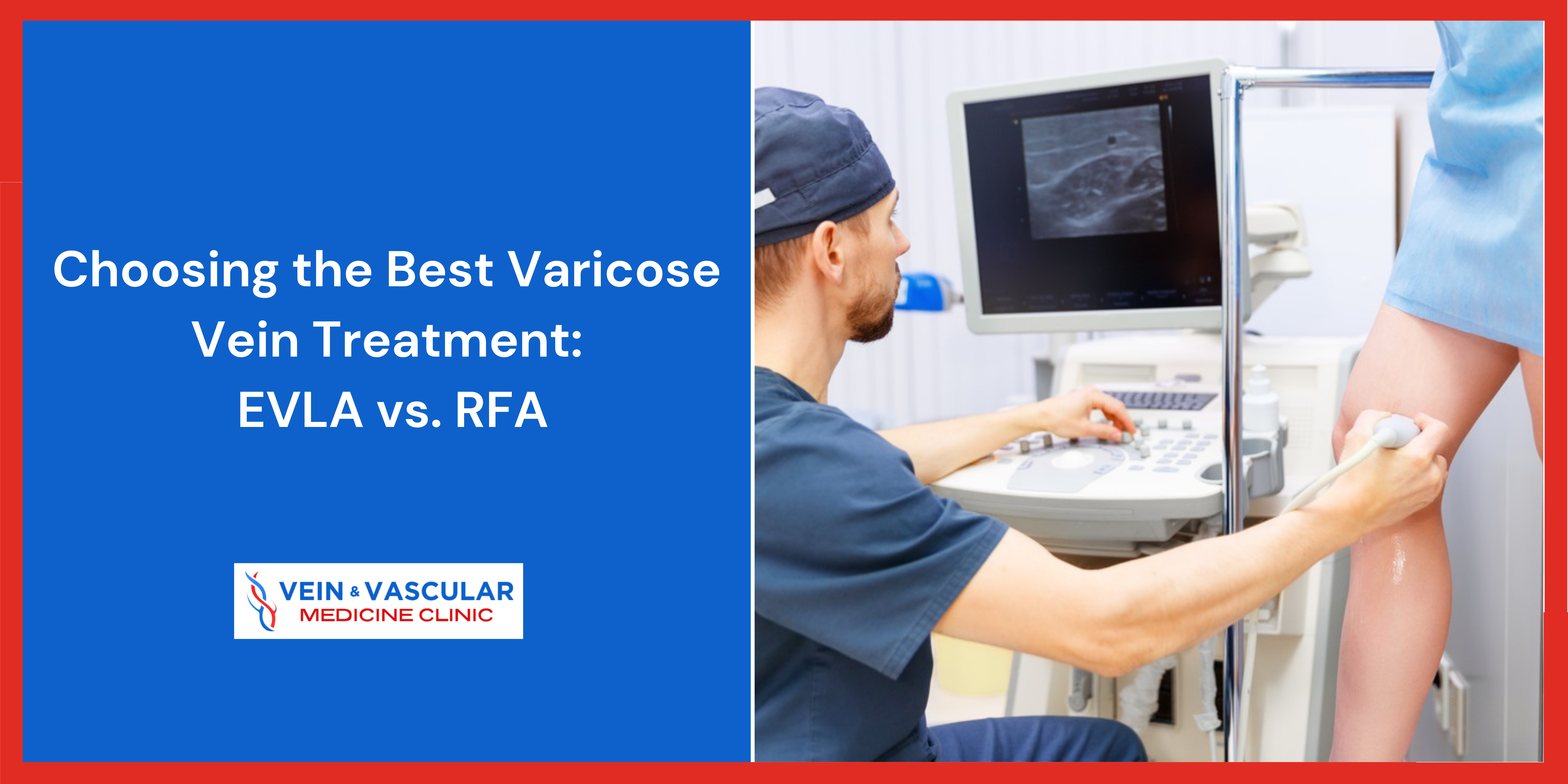 Choosing the Best Varicose Vein Treatment: EVLA vs. RFA