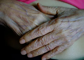 Face, Chest, Hand & Foot Veins Image