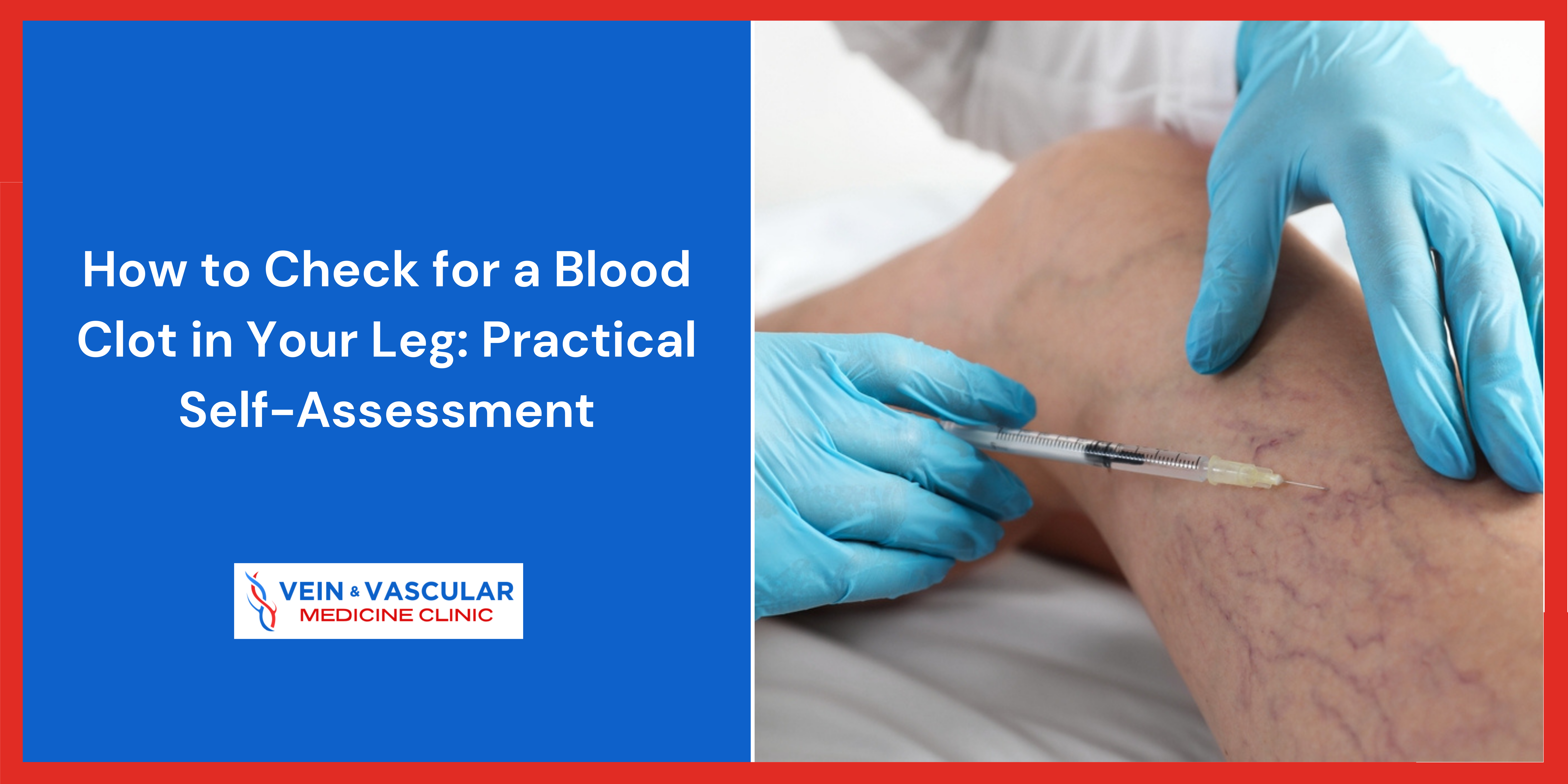 How to Check for a Blood Clot in Your Leg: Practical Self-Assessment