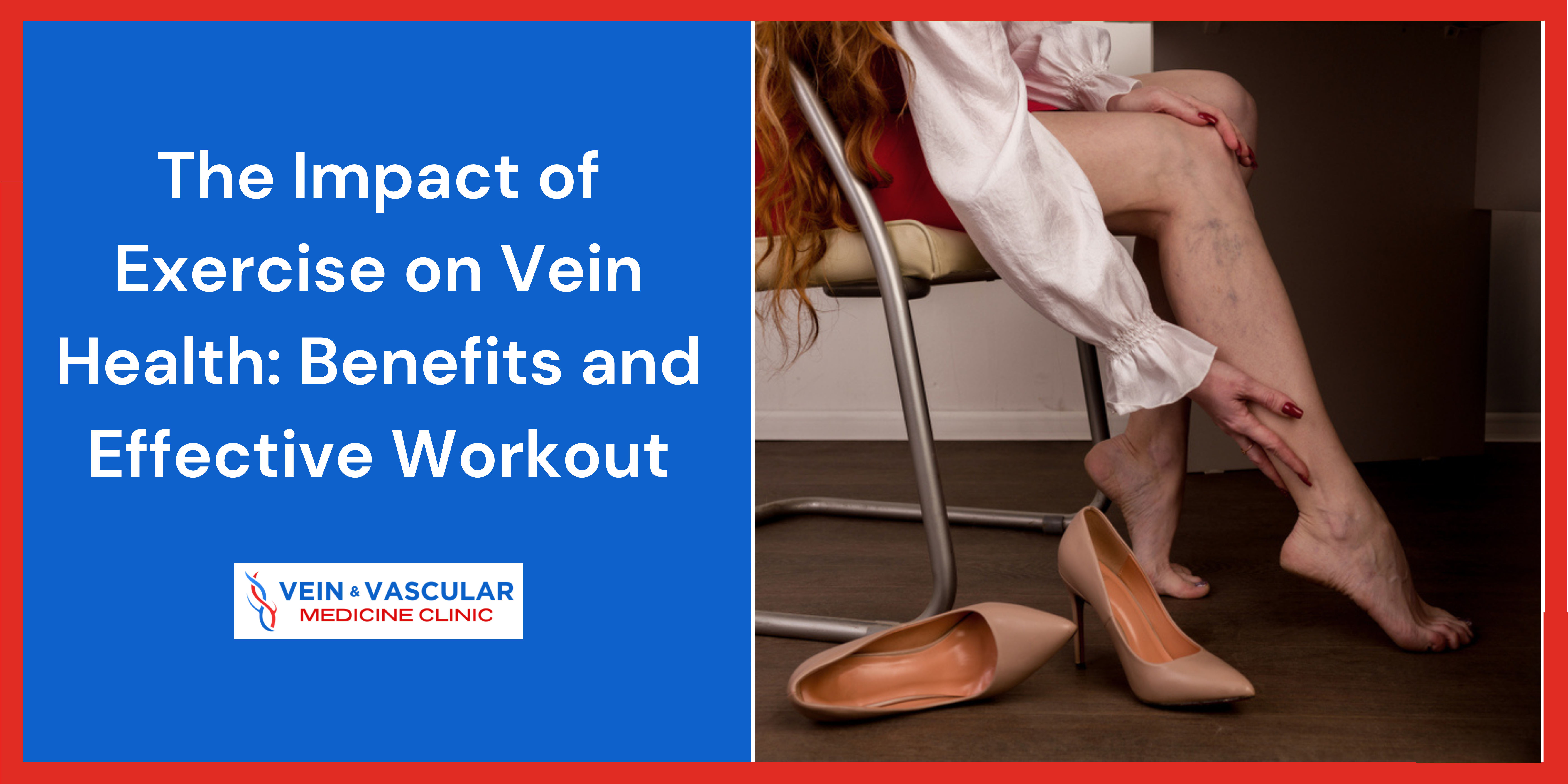 The Impact of Exercise on Vein Health: Benefits and Effective Workout