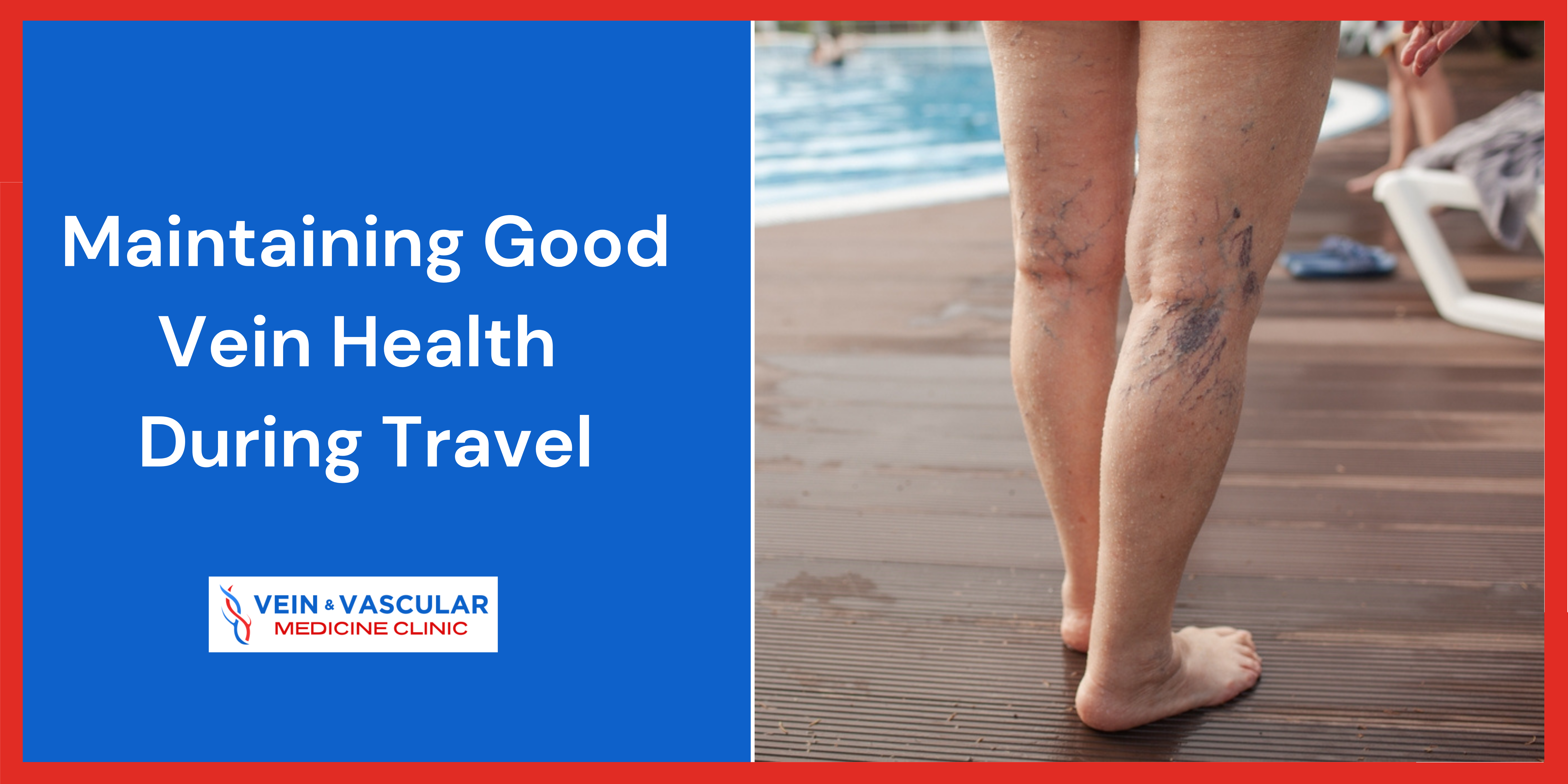 Maintaining Good Vein Health During Travel