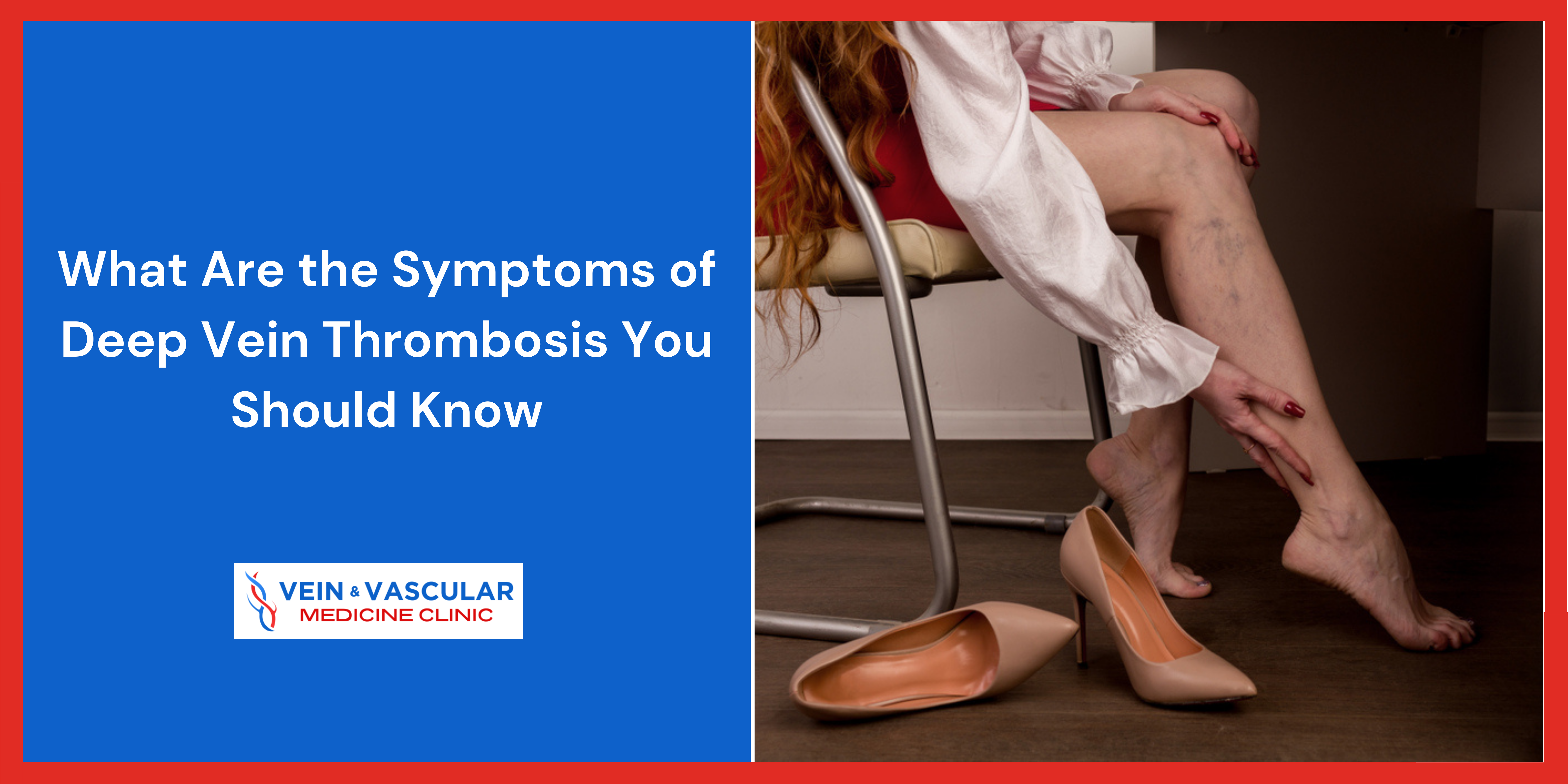 What Are the Symptoms of Deep Vein Thrombosis You Should Know