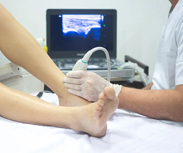 Vascular Ultrasound