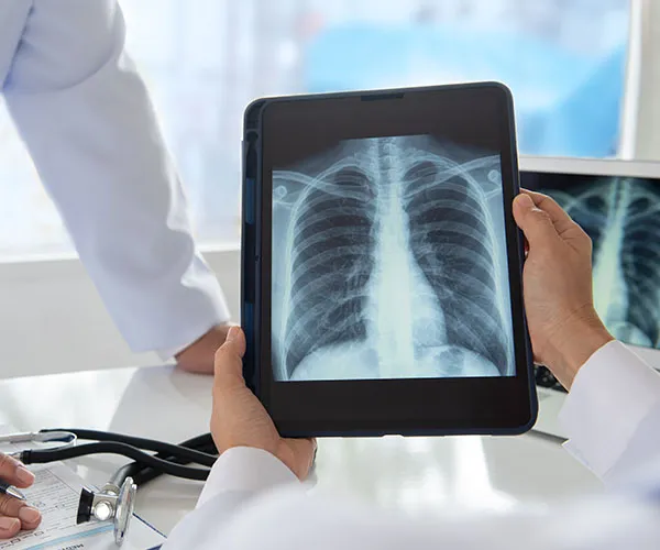 Digital X-Ray