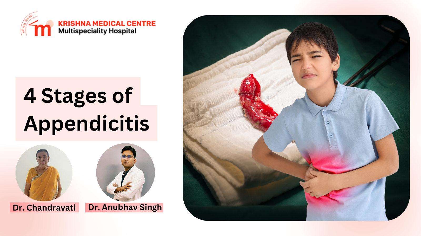4 Stages of Appendicitis: How the Disease Progresses