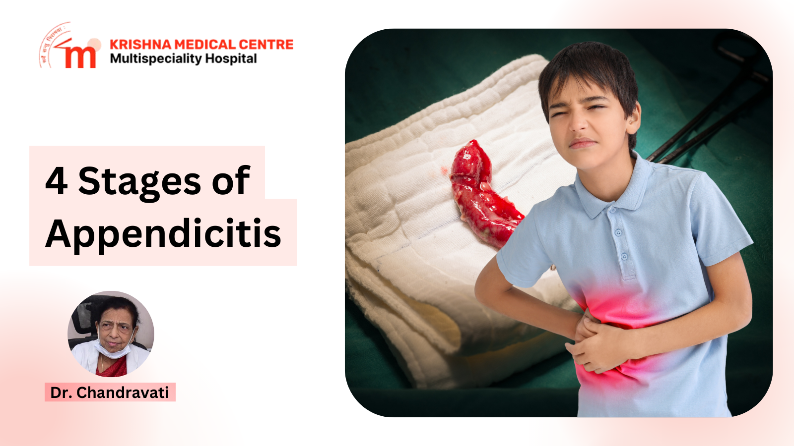 4 Stages of Appendicitis: How the Disease Progresses