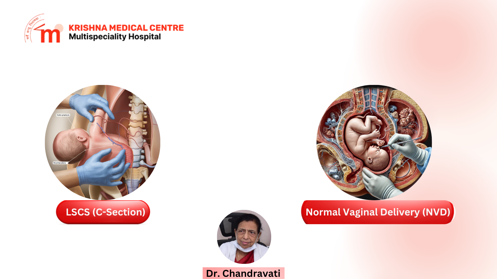 Comparison of Normal Vaginal Delivery and LSCS C-section with benefits, risks, recovery, and expert medical guidance.