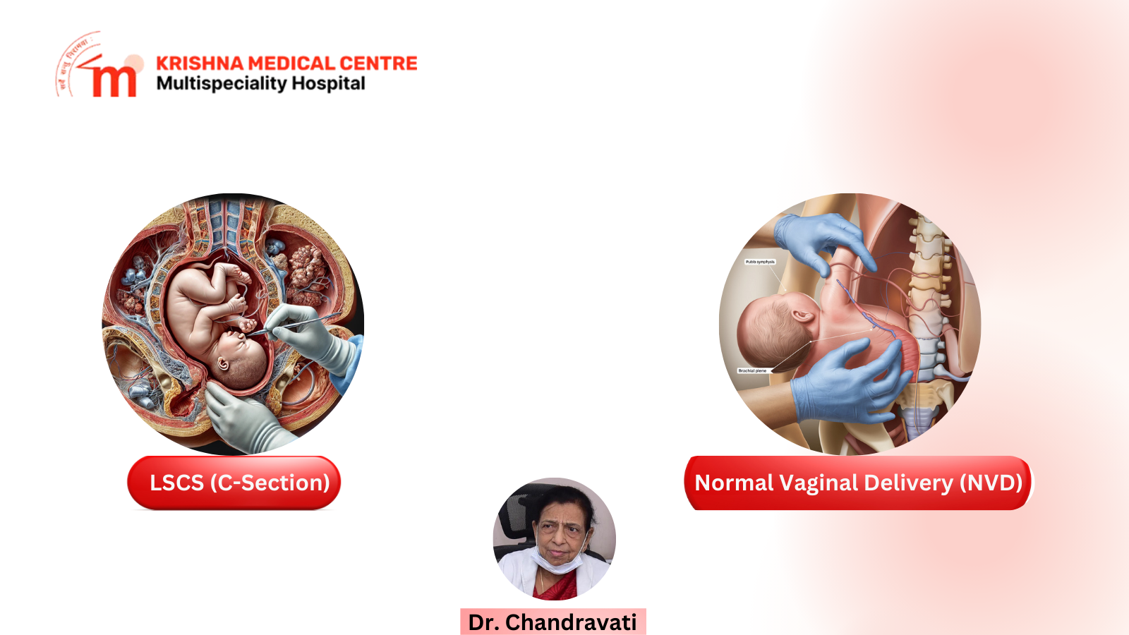 Comparison of Normal Vaginal Delivery and LSCS C-section with benefits, risks, recovery, and expert medical guidance.