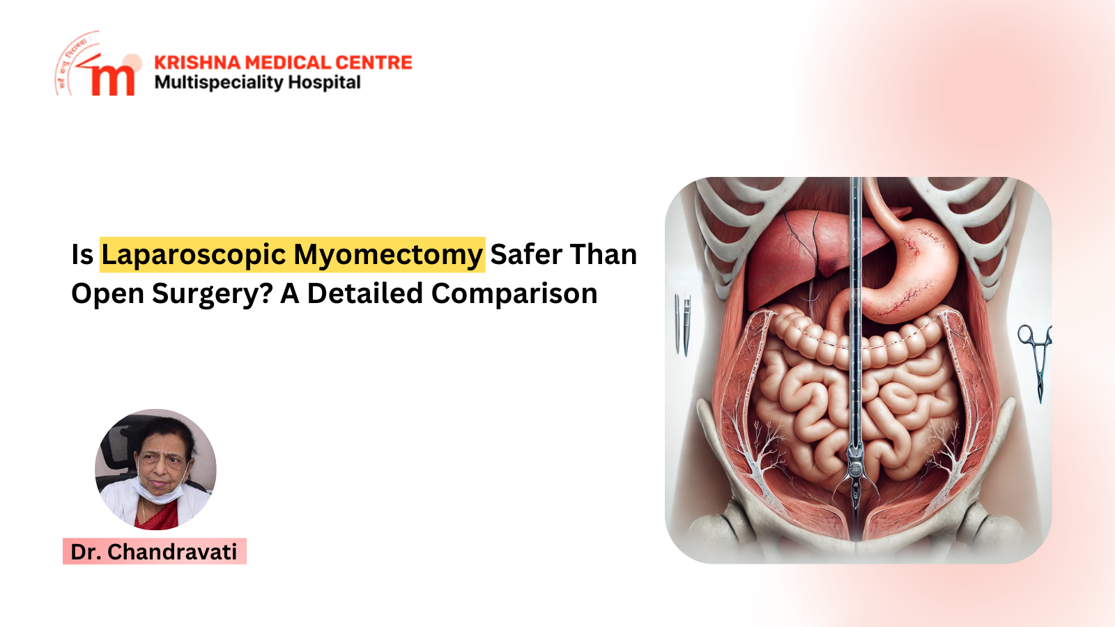 Laparoscopic myomectomy offers faster recovery, less blood loss, and fewer complications compared to open surgery for fibroid removal.