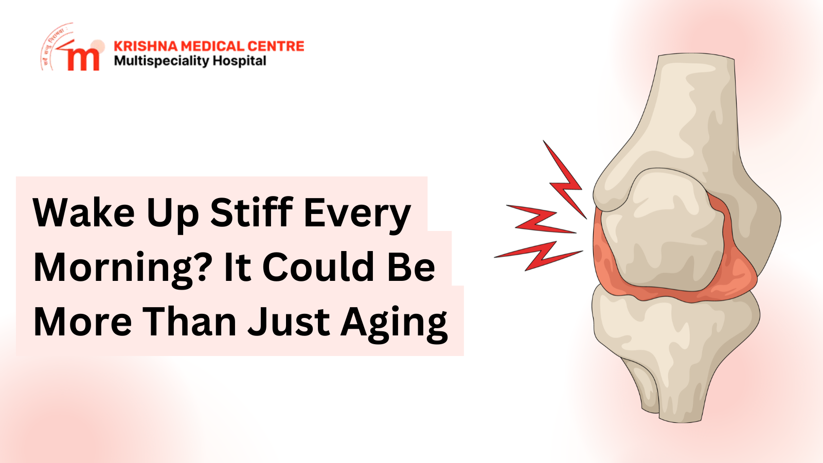 Is Your Morning Joint Stiffness Linked to Arthritis? Signs You Should Not Ignore