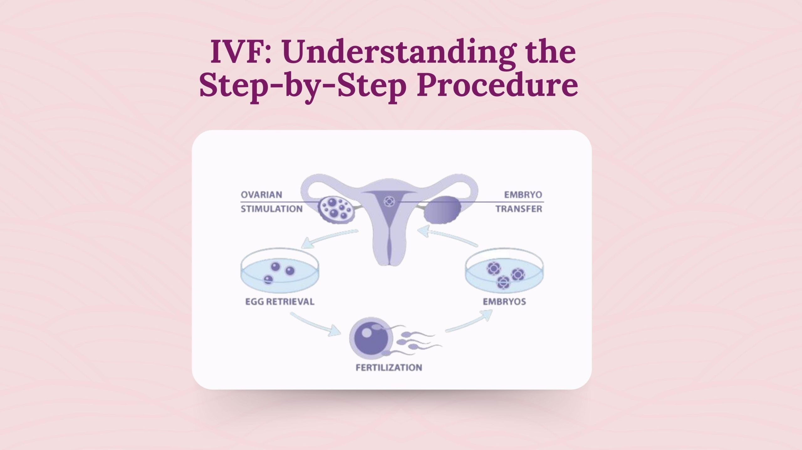 IVF: Understanding the Step-by-Step Procedure