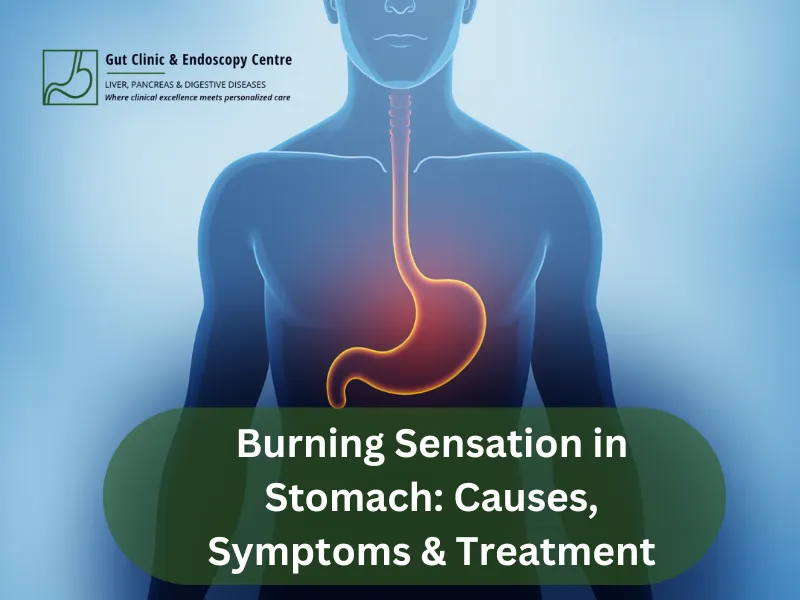 Burning Sensation in Stomach: Causes, Symptoms & Treatment