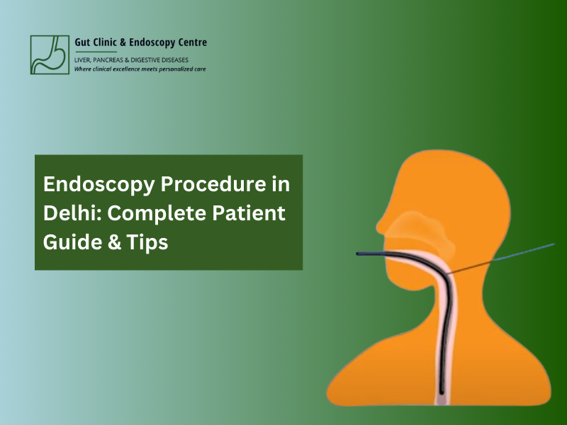 Endospcopy Endoscopy Procedure in Delhi: Complete Patient Guide & Tips