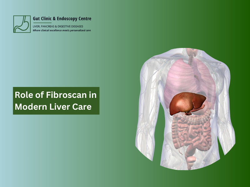 fibroscan in modern liver care