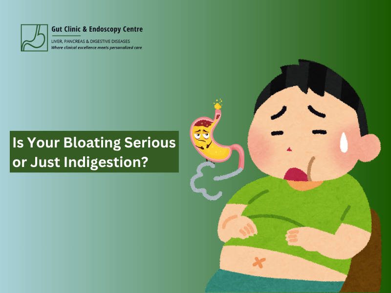 How Do I Know If My Bloating Is Serious or Just Indigestion?