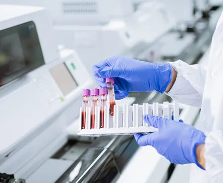 Lab Tests