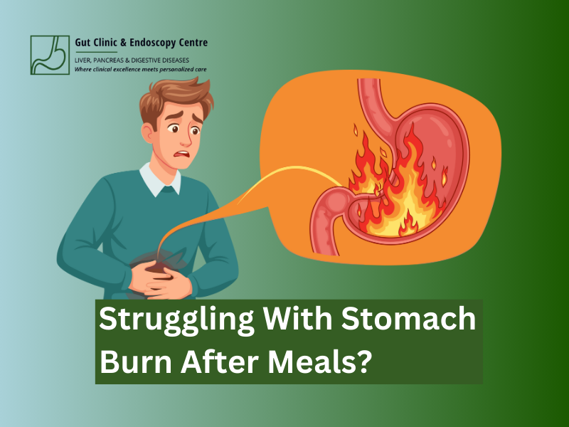 Why Is My Stomach Burning After I Eat? Causes and Quick Relief Explained