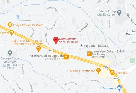 alpharetta