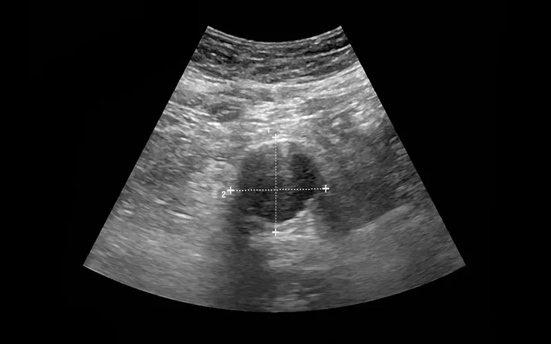Common uses of the procedure