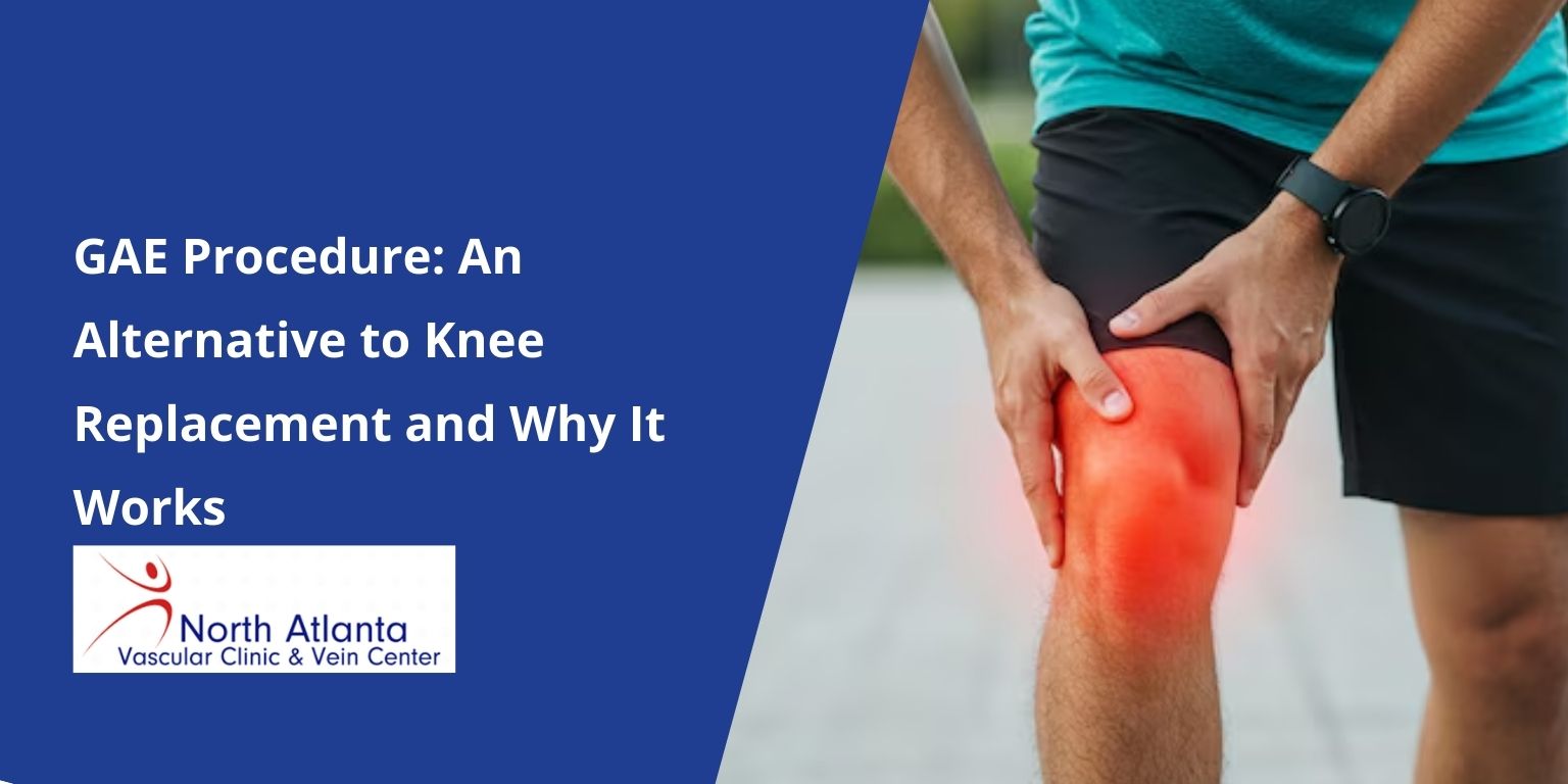 GAE Procedure: An Alternative to Knee Replacement and Why It Works