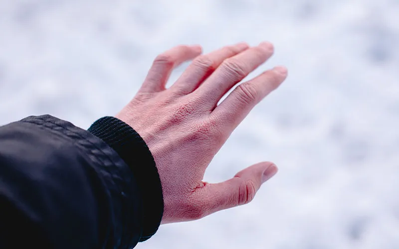 Cold Hands Specialist