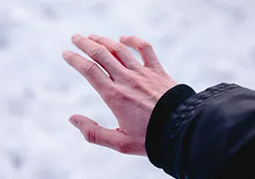 Cold Hands