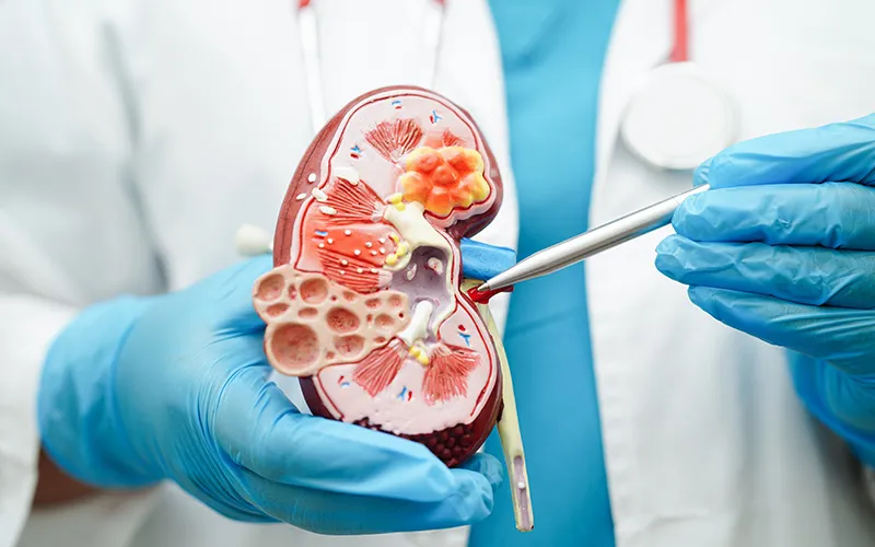 Dialysis Access Specialist