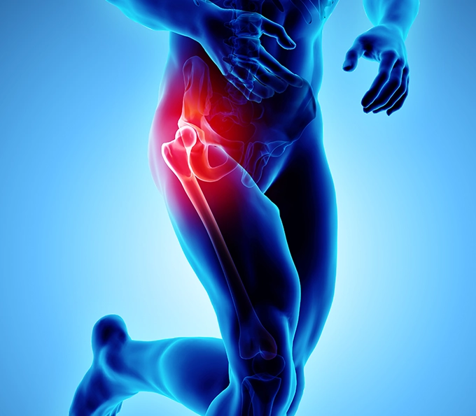 Common Symptoms of Hip Arthritis