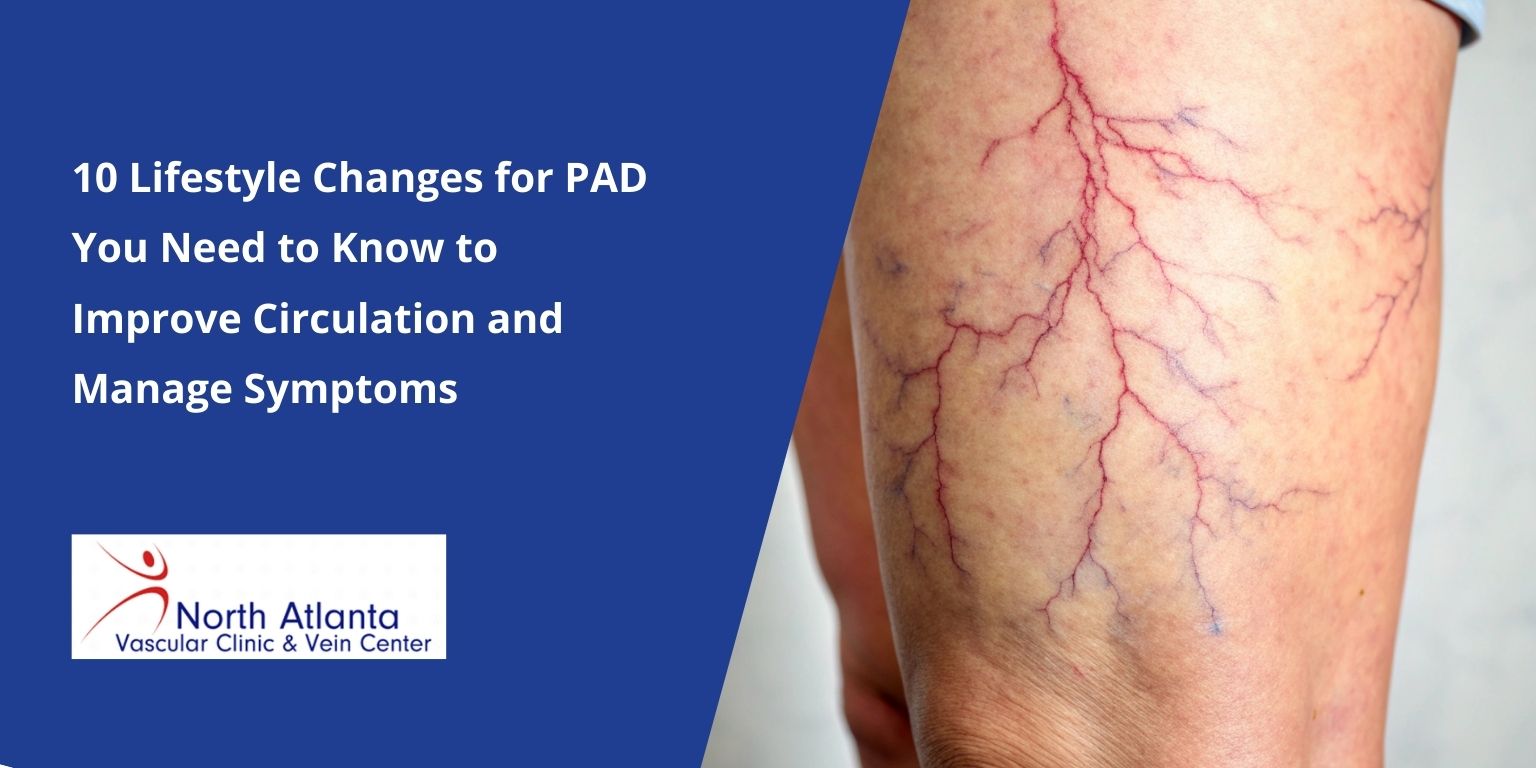10 Lifestyle Changes for PAD You Need to Know to Improve Circulation and Manage Symptoms