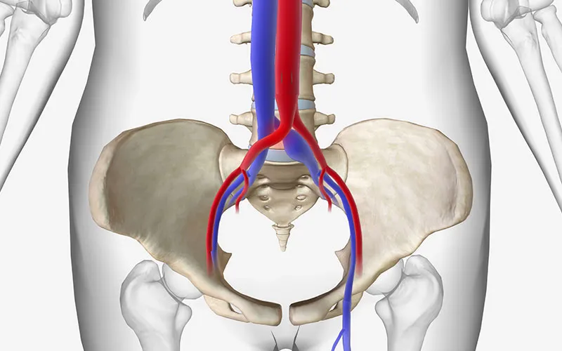 Abdominal Aortic Aneurysm Specialist