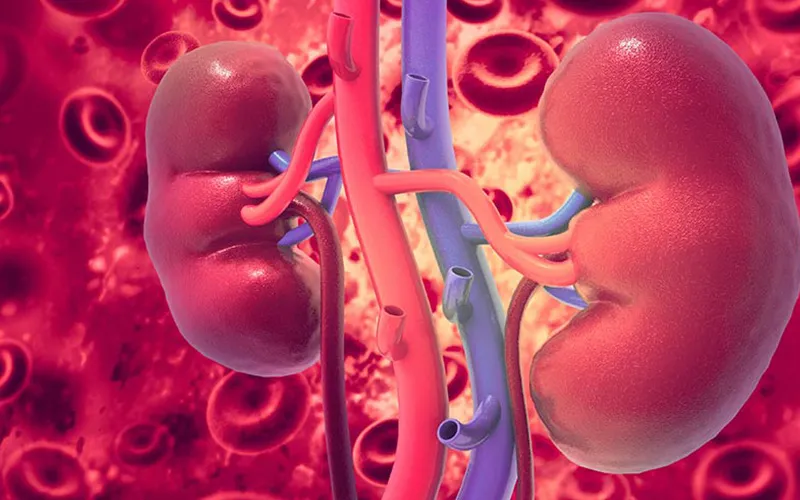 Arterial Duplex Scan