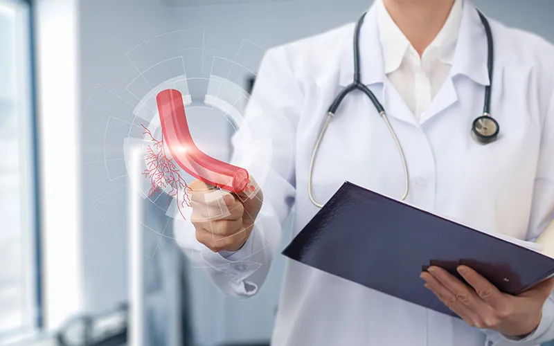 Peripheral Artery Disease (PAD)