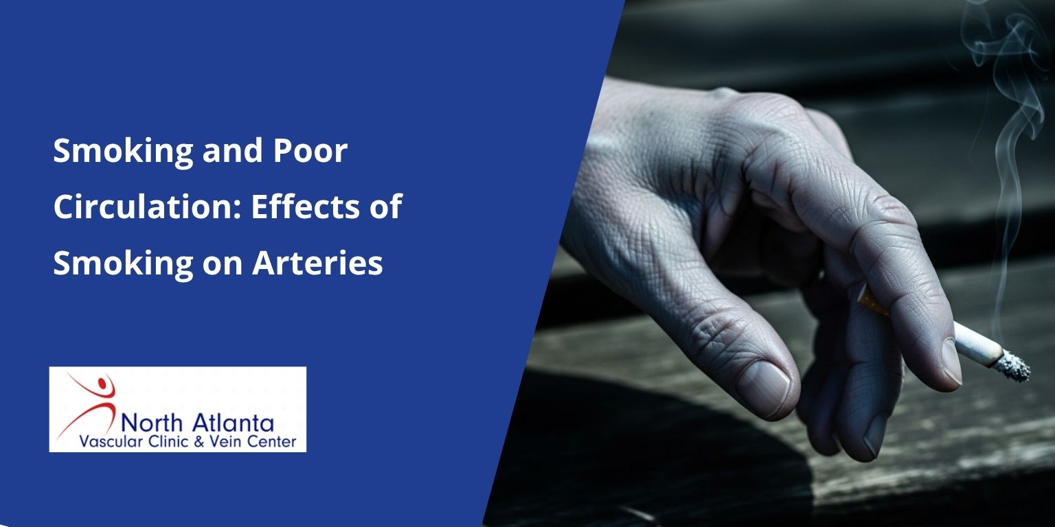 Smoking and Poor Circulation: Effects of Smoking on Arteries